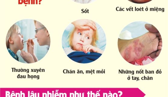 Vì sao bệnh tay chân miệng có khả năng tái phát và nguy hiểm? Vì sao bệnh tay chân miệng có khả năng tái phát và nguy hiểm?