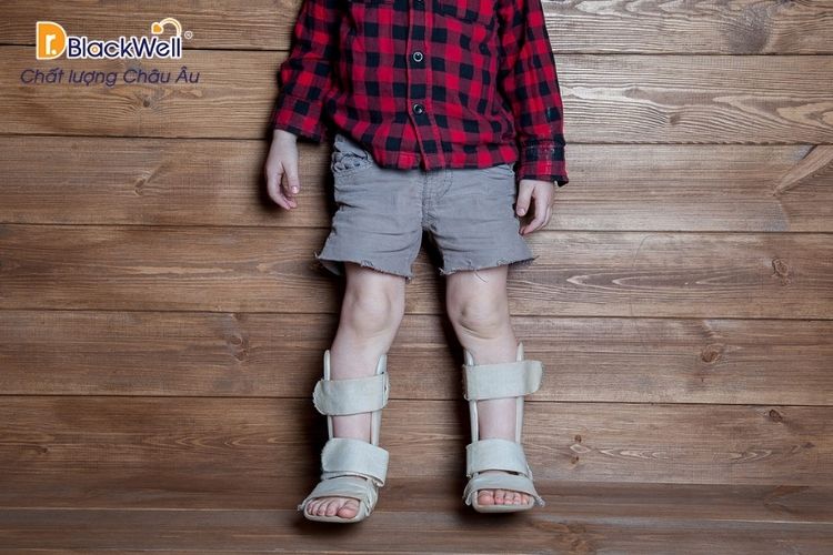 Tre coi xuong co the phat trien thanh chan vong kieng